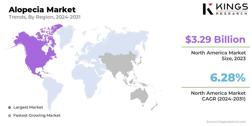 Alopecia Market Size & Share, By Region, 2024-2031